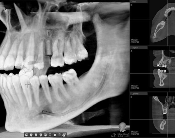 dentistas en ejea
